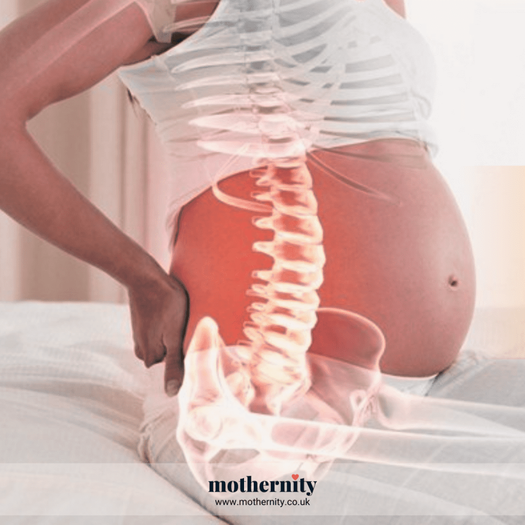 Sciatica or low back pain in late pregnancy